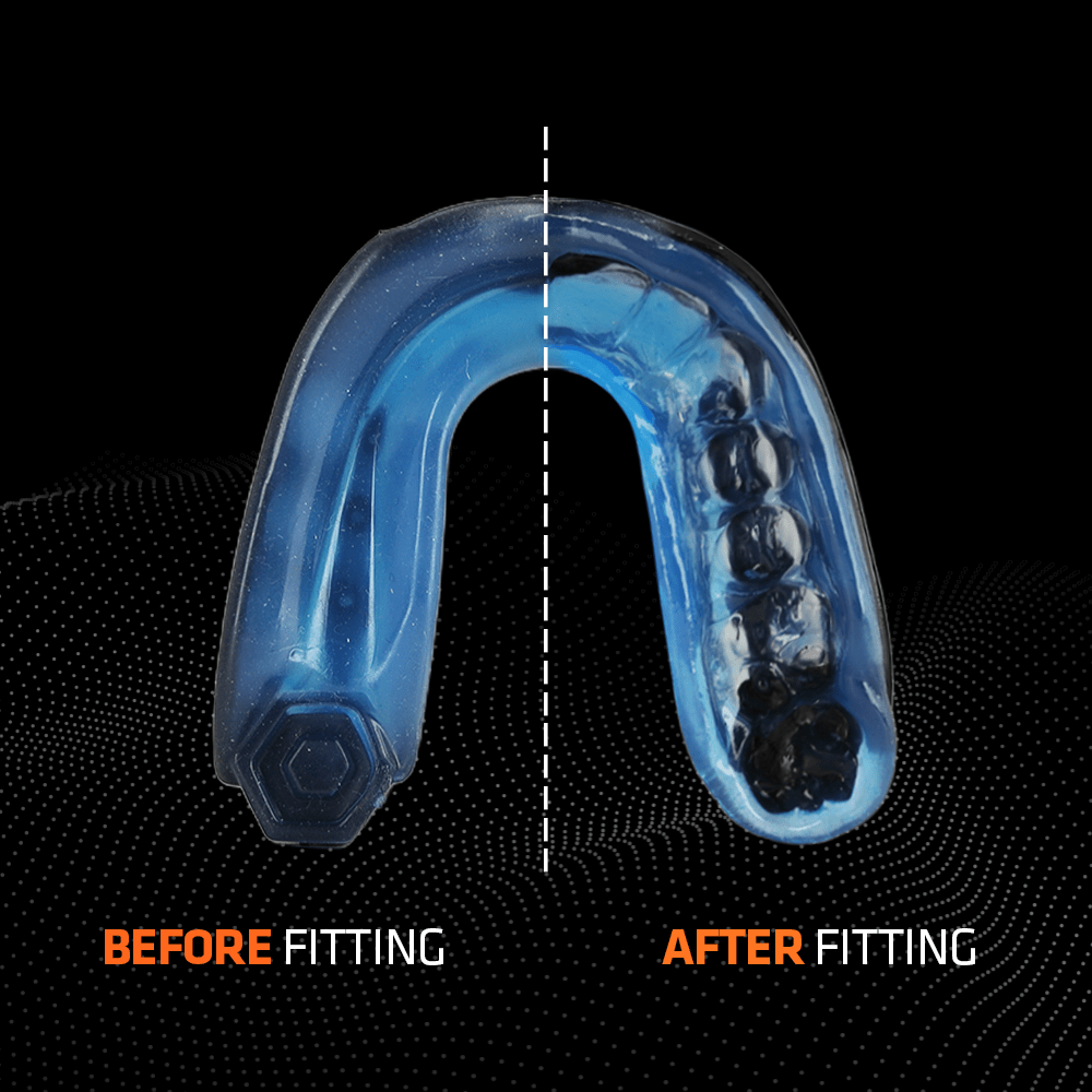 Shock Doctor Gel Max Mouthguard