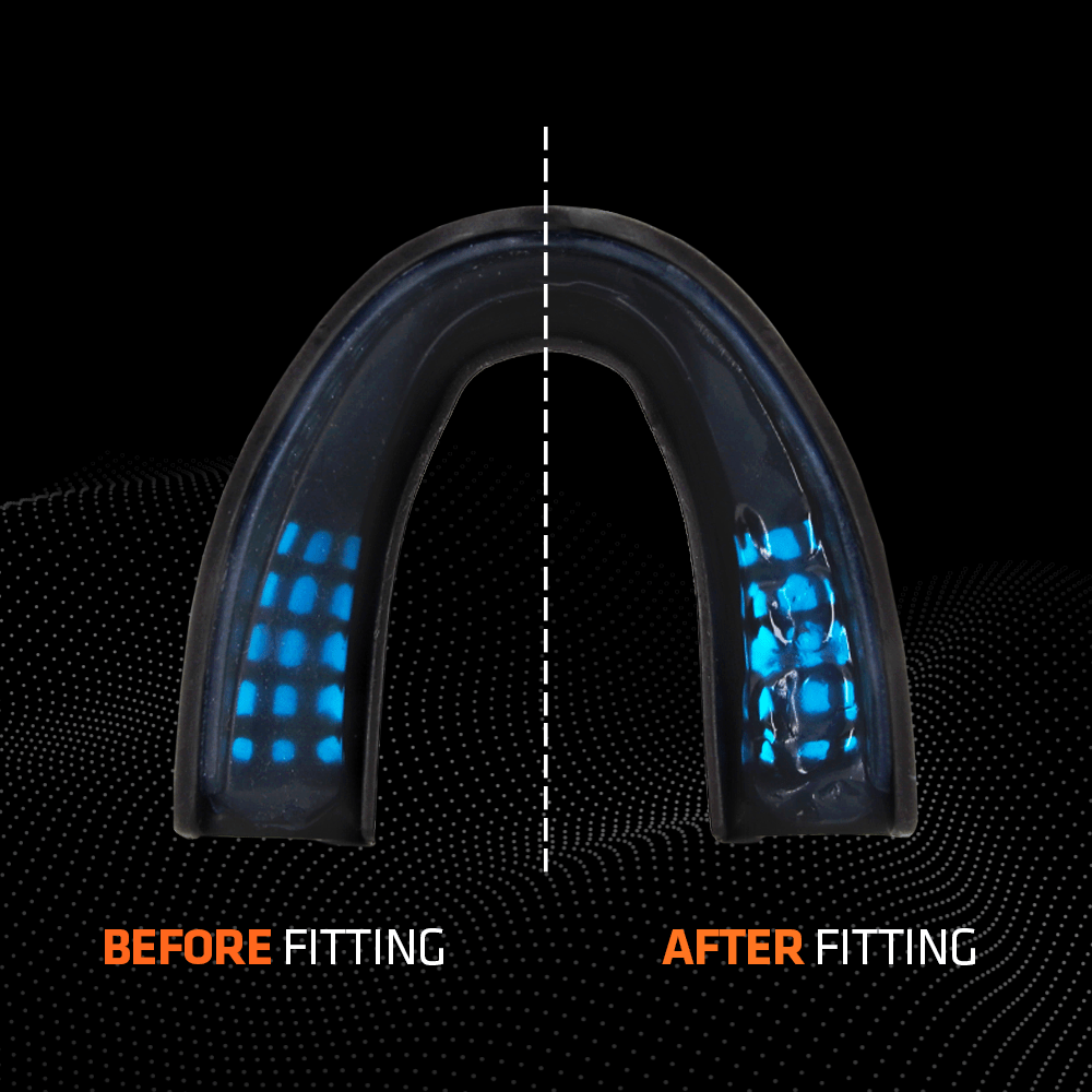 Shock Doctor SuperFit Power Mouthguard